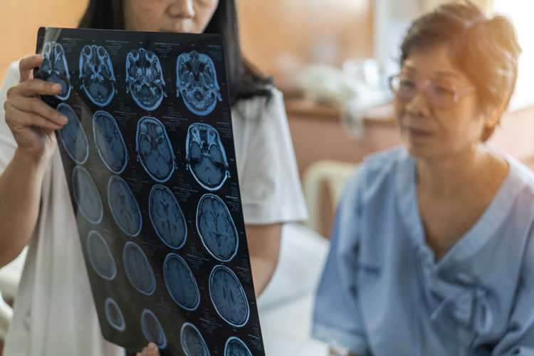 Head Trauma in Seniors